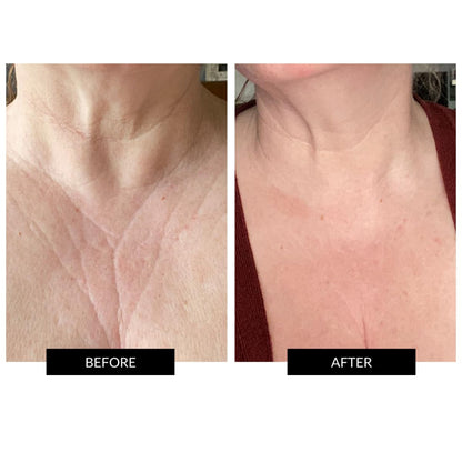 Red Light Therapy Flexible Face Mask