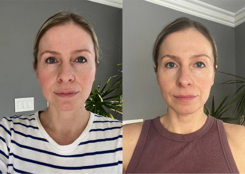 Red Light Therapy Flexible Face Mask