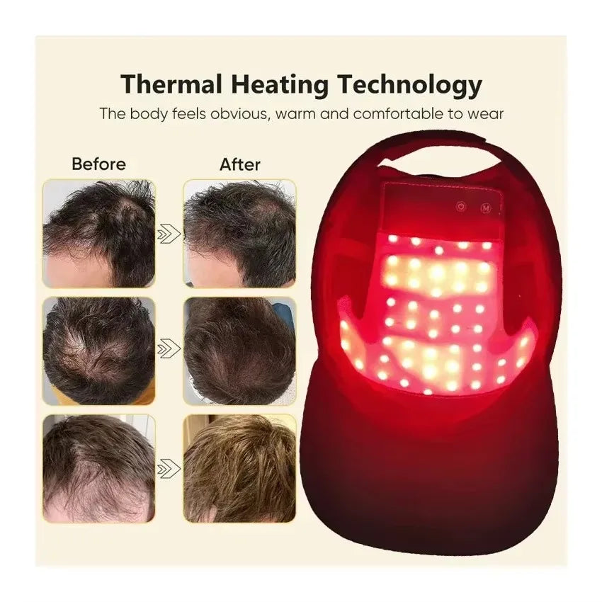 Red Light Therapy Hair Growth Cap
