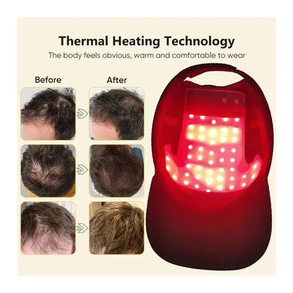 Red Light Therapy Hair Growth Cap